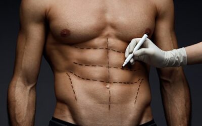 L’abdominal etching ou sculpture des abdominaux