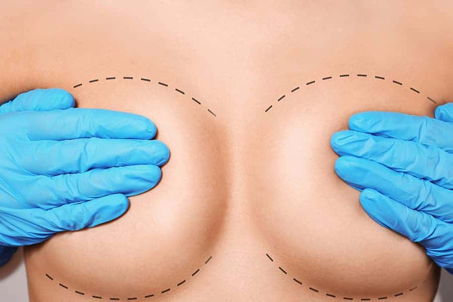 temps de recuperation apres augmentation mammaire post op chirurgie mammaire paris docteur jerry levy chirurgien esthetique paris
