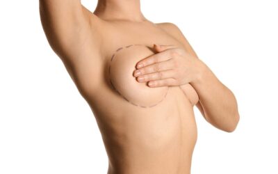 Lipofilling mammaire après mastectomie