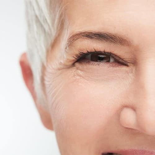 ride-botox-patte-d-oie-prix-medecin-esthetique-paris-dr-levy-jerry-chirurgien-esthetique-paris