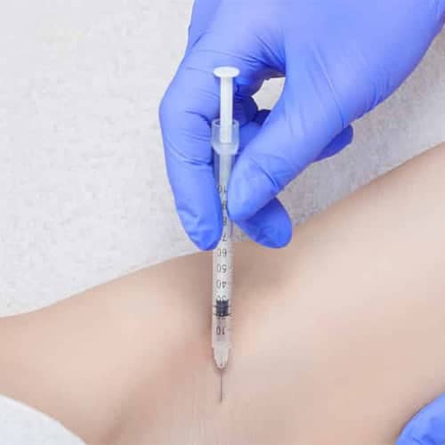 transpiration-excessive-traitement-hypersudation-main-aisselles-medecin-esthetique-paris-dr-levy-jerry-chirurgien-esthetique-paris