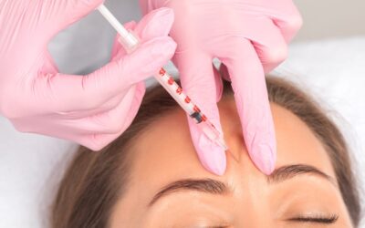 Quel est le prix des injections de Botox pour la ride du lion ?