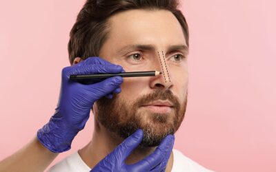 Rhinoplastie pour homme : quel prix ?