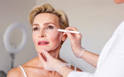 Oedème après un lifting cervico facial : durée et causes