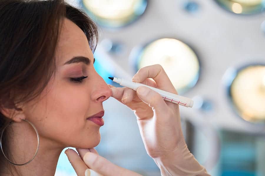 chirurgie enlever bosse du nez rhinoplastie chirurgie du nez docteur jerry levy chirurgien esthetique chirurgie du visage medecine esthetique paris